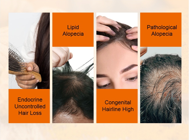 OPHELIA KelpDNA Scalp Oil