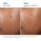 SkinCeuticals Phyto A+ Brightening Treatment Lightweight Moisturizer